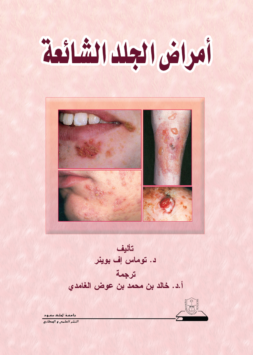 أمراض الجلد الشائعة