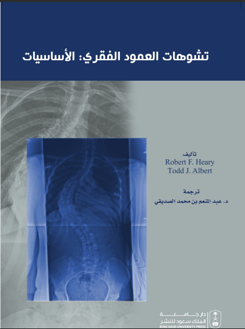 تشوهات العمود الفقري: الأساسيات