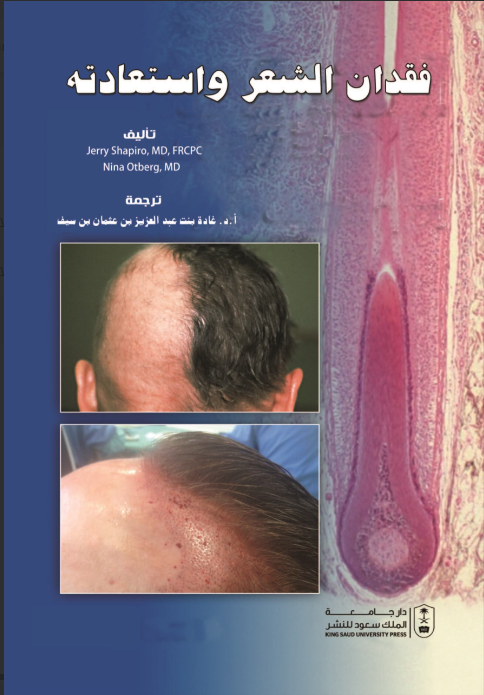 فقدان الشعر واستعادته