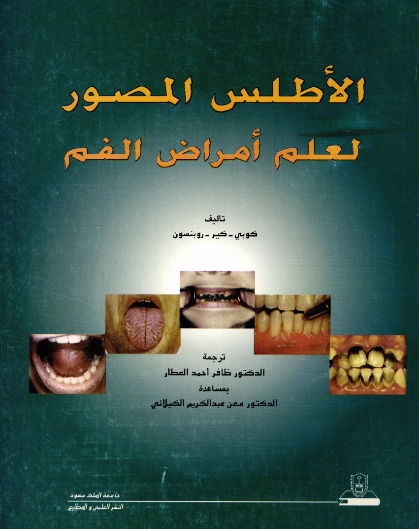 الأطلس المصور لعلم أمراض الفم