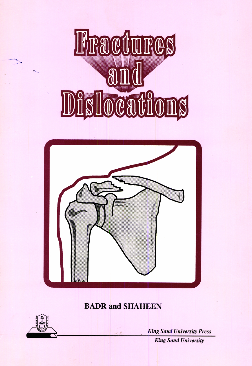Fractures and Dislocations