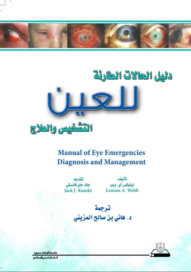 دليل الحالات الطارئة للعين: التشخيص والعلاج