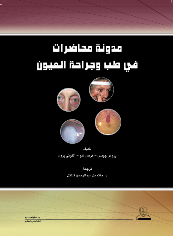 مدونة محاضرات في طب وجراحة العيون