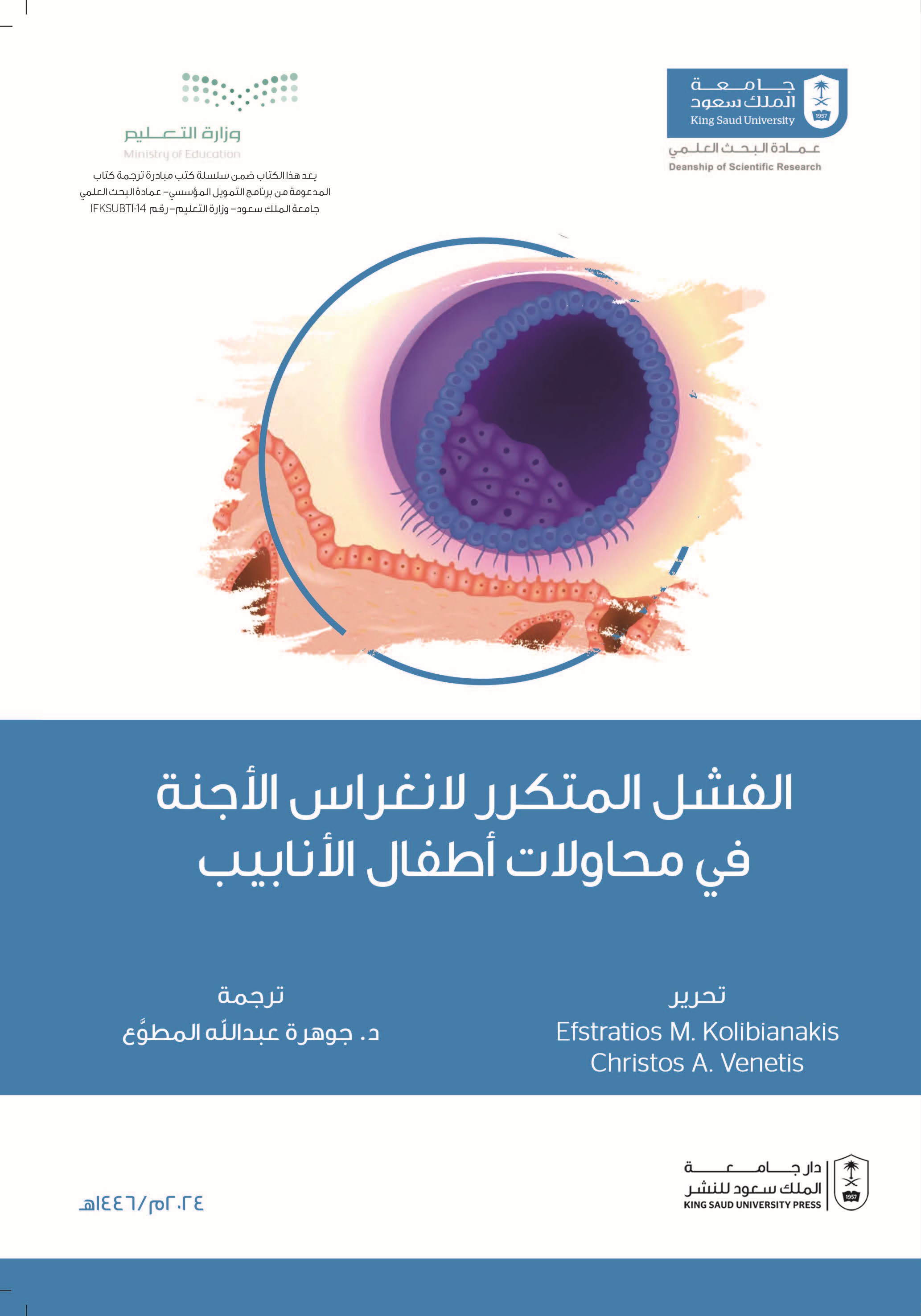 الفشل المتكرر لانغراس الأجنة في محاولات أطفال الأنابيب