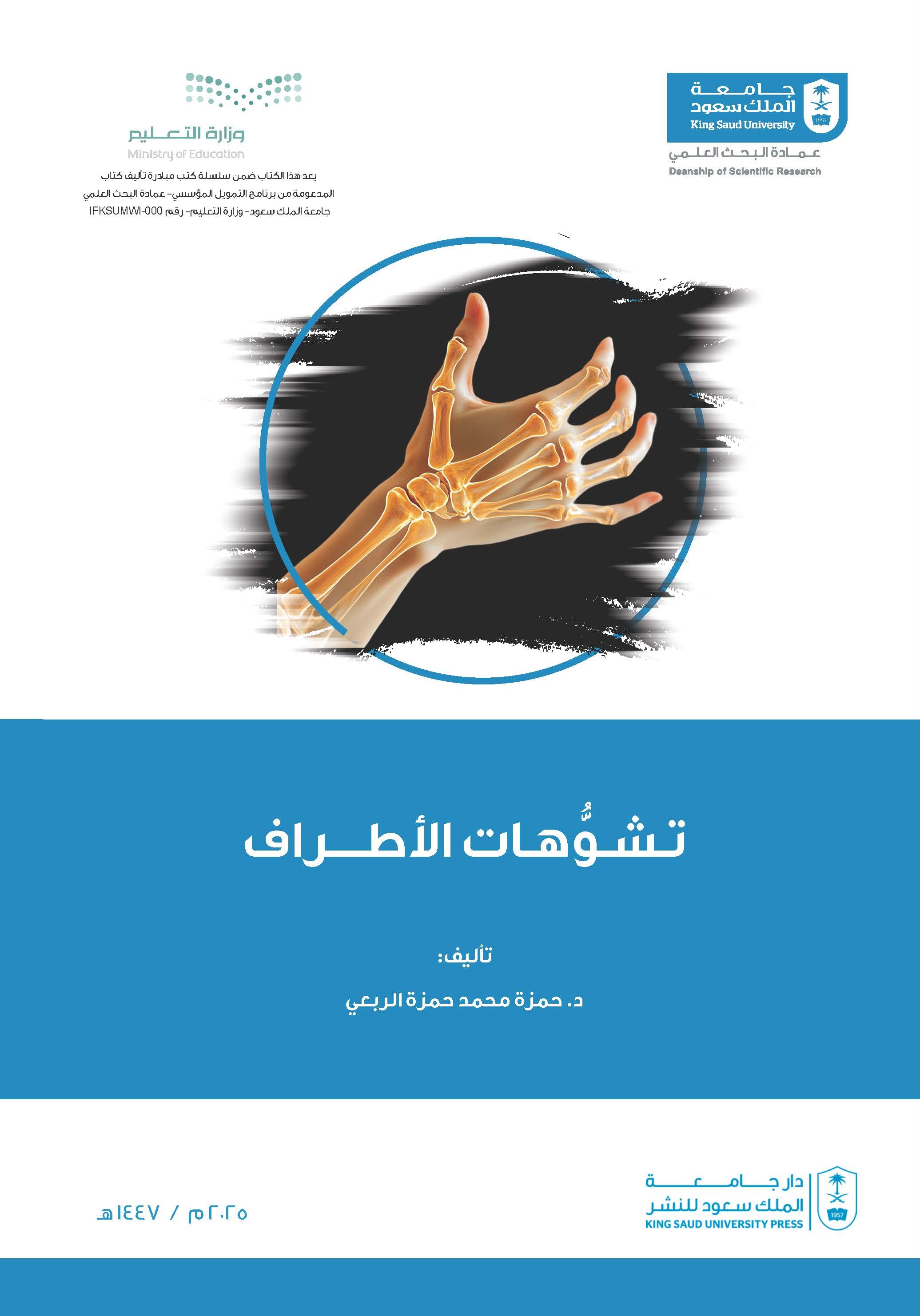 تشوهات الأطراف 
