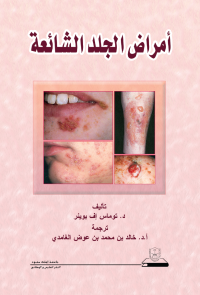 أمراض الجلد الشائعة