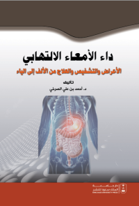 داء الأمعاء الالتهابي: الأعراض والتشخيص والعلاج من الألف إلى الياء