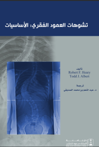 مبادئ تشوهات العمود الفقري