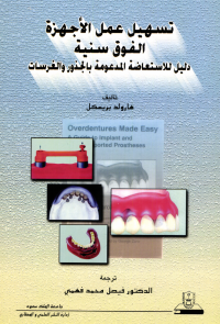 تسهيل عمل الأجهزة الفوق سنية