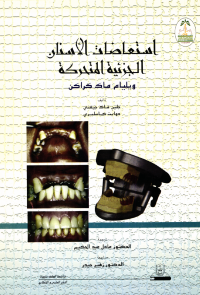 استعاضات الأسنان الجزئية المتحركة
