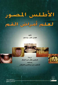 الأطلس المصور لعلم أمراض الفم
