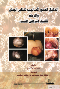 الدليل المصور لأساليب تنظير البطن والدم لأطباء أمراض النساء