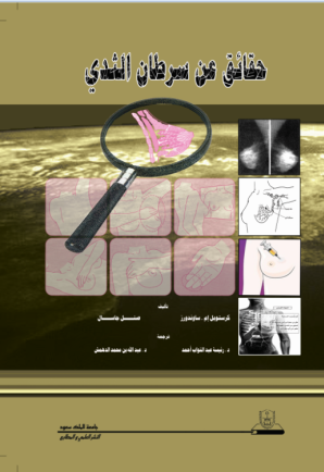 حقائق عن سرطان الثدي