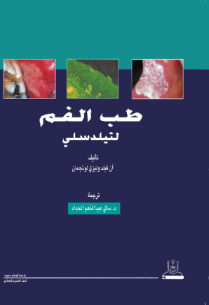 طب الفم لتيلدسلي