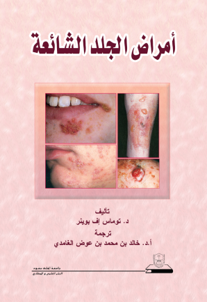 أمراض الجلد الشائعة
