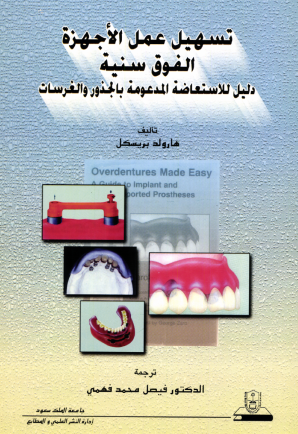 تسهيل عمل الأجهزة الفوق سنية