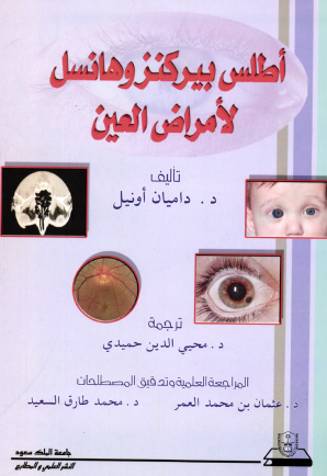أطلس بيركنز وهانسل لأمراض العين