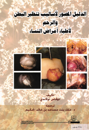 الدليل المصور لأساليب تنظير البطن والدم لأطباء أمراض النساء