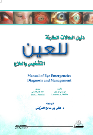 دليل الحالات الطارئة للعين: التشخيص والعلاج