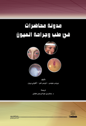 مدونة محاضرات في طب وجراحة العيون